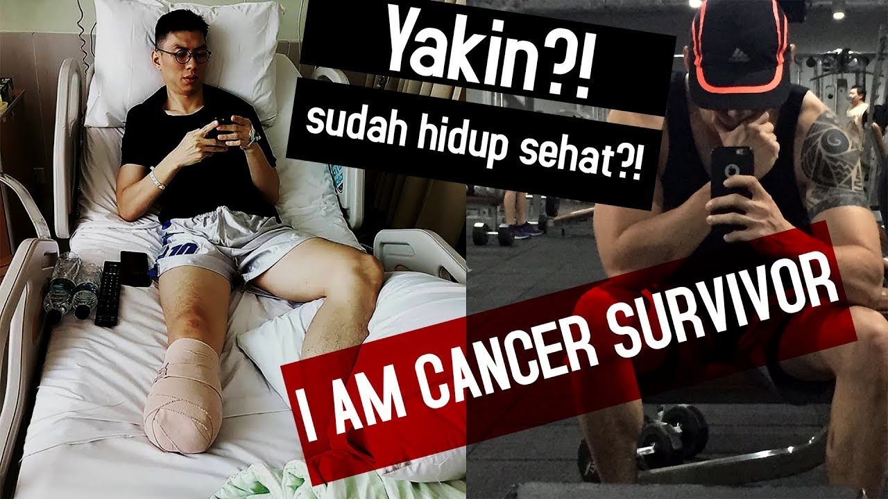 Yakin sudah merasa sehat?! Kisah hidup Cancer Survivor yang sudah di Amputasi