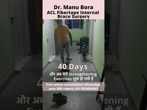 ACL सर्जरी के अगले ही दिन से मेरी सारी एक्सरसाइज शुरू हो गई #aclrecovery #drmanubora