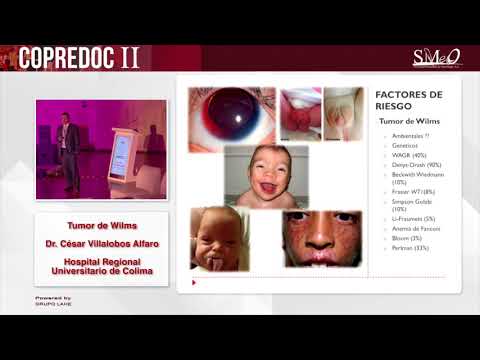 Vídeo: Perfil Proteômico De Retinoblastoma Por Espectrometria De Massa De Alta Resolução