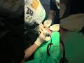 #Dreamhairline#hairrestoration #hairtreatment #hairtransplant #stemcellhairtrant#fuehairtrantseoul