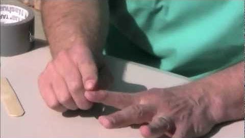 How to Splint Different Finger Injuries