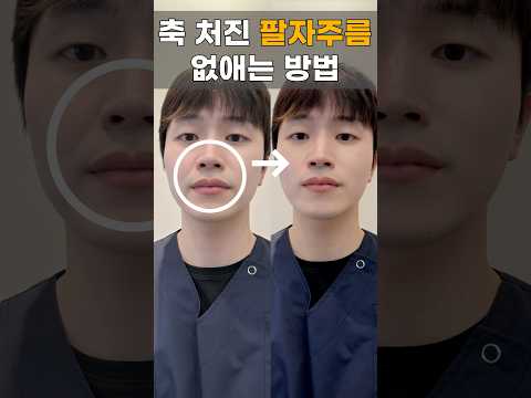 집에서 쉽게 <strong>팔자주름</strong> 펴는 방법
