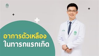 อาการตัวเหลืองในทารกแรกเกิด