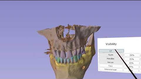 SlicerVR GUI widget interactions demo