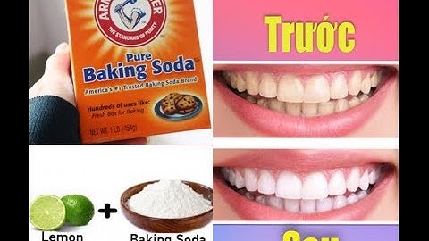 Răng SẠCH bong Ố VÀNG nhờ Baking Soda trong vòng 3 phút | Topic 12: Trắng răng Baking Soda