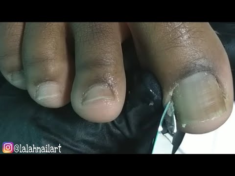 Vídeo: Como Limpar Sob As Unhas: Unhas, Unhas Dos Pés E Dicas