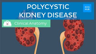 Polycystic kidney disease: pathology, symptoms, diagnosis and treatment | Kenhub