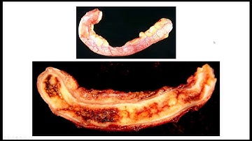 ROC Curves Demystified