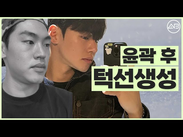 남자가 안면윤곽수술을 하면? | 성형비포애프터 | 에이비성형외과