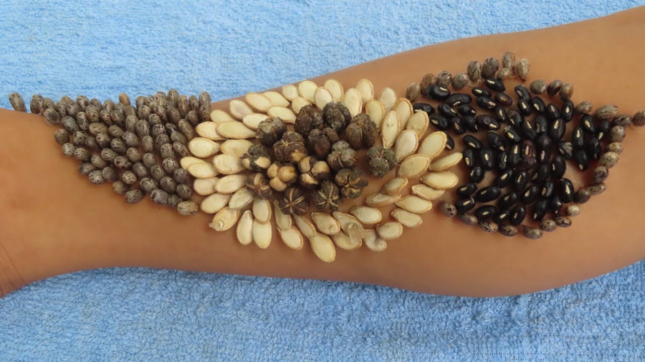 Amazing removing many kinds of ticks style on leg Designed from cereals 338 YouTube