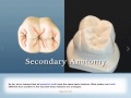 PTC Training - Posterior Dental Anatomy Demo
