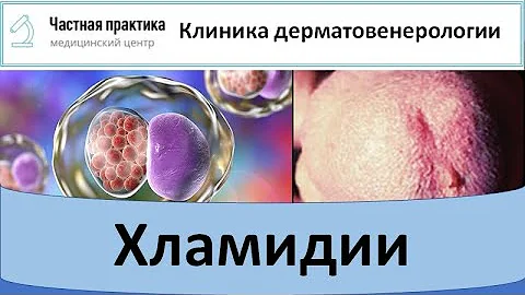 Хламидии