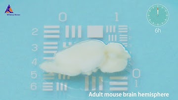 Fast, efficient and non-toxic tissue clearing of a mouse brain using the MACS® Clearing Kit