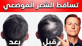 ثلاث معادن تساعد حتماً في منع تساقط الشعر الموضعي (ثعلبة)