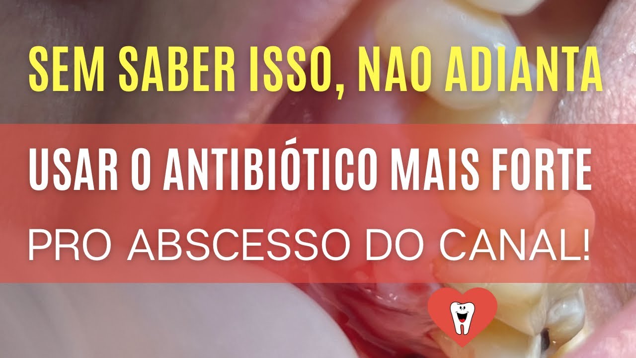 NÃO ADIANTA ACHAR QUE PRESCREVEU O ‘ANTIBIÓTICO MAIS FORTE’ PRO ...