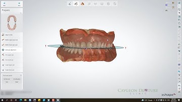 Reference Denture Design