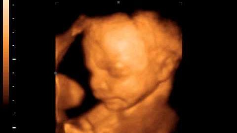 26 weken jonge baby