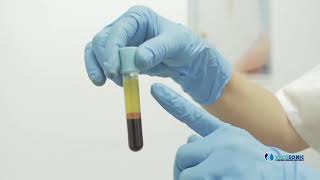 PLasma Gel D-جهاز يحول الدم الى فيلر جل
