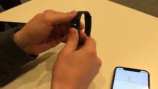 Joint effort between Mawi and XOresearch on wearable ECG-capable de...