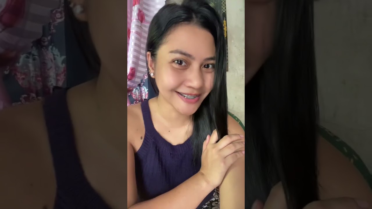 Нет, я просто выглядел мило.😂 Брекеты от Dentofix Dental Lounge 