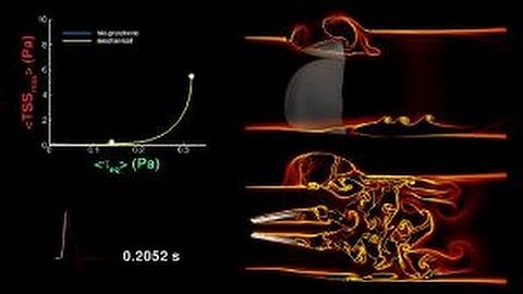 Straight From The Heart: Complex Flowfields Through Prosthetic Valves