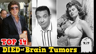 Top 14 Celebrities Who DIED of Brain Tumors