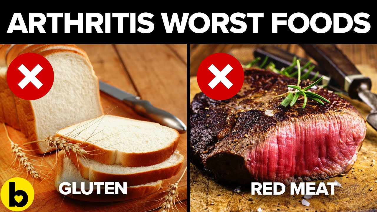 7 Foods and Beverages to avoid with Arthritis