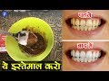 Home remedies for clean teeth in hindi  by ishan