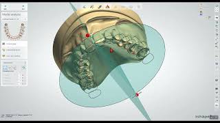 Creating Prostheses with Novaloc & MedentiLOC Library in 3Shape Dental System (2024)