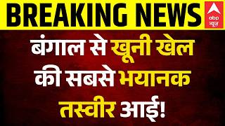 Bengal Breaking News: खूनी खेल की सबसे भयानक तस्वीर! | BJP Vs TMC | 1st Phase Voting Violence |