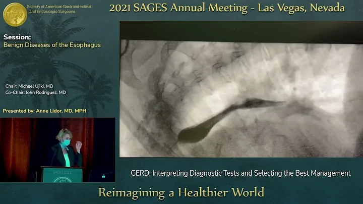 GERD: Interpreting Diagnostic Tests and Selecting ...