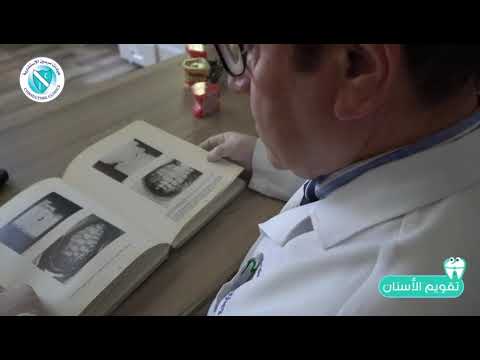 متى تحتاج تقويم الأسنان دكتور نبيل حجار        