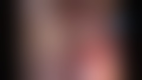 laparoscopic cholecystectomy, calot dissection