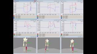 Orthosis comparison with gait biomechanics being evaluated in Simi Motion