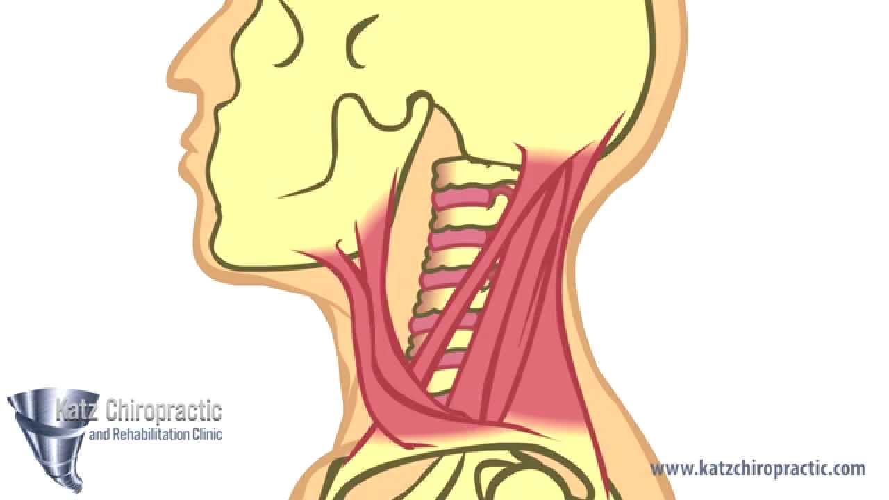 Katz Chiropractic Animated Neck Video - YouTube