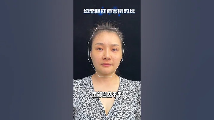 留言評價下她看起年輕了多少歲 #整形 #醫美 #幼態臉 - 天天要聞