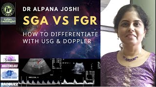 SMALL FOR GESTATION FOETUS vs GROWTH RESTRICTED FOETUS - HOW TO DIFFERENTIATE | DR ALPANA JOSHI