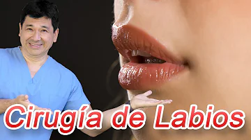 ¿Es posible dar forma a los labios?