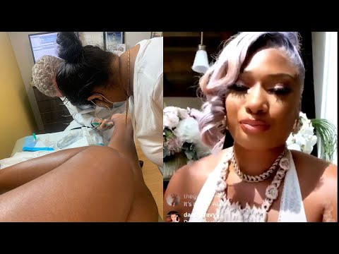 Megan Thee Stallion Injuries From Shooting Incident Were No Joke