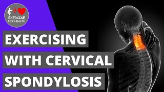 Cervical Spondylosis Exercises and Stretches to reduce pain and stiffness