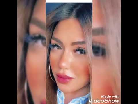 صدمه في شكل الفنانه ساره سلامه بعد فشل عمليه التجميل