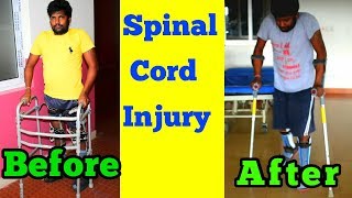 spinal cord injury paraplegic before and after improvement