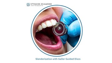 Slenderization Systems for IPR - Strauss Diamond