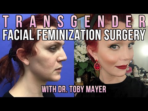 Transgender Facial Feminization