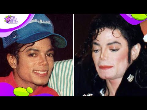 السبب الحقيقي لتحول لون مايكل جاكسون للون الأبيض