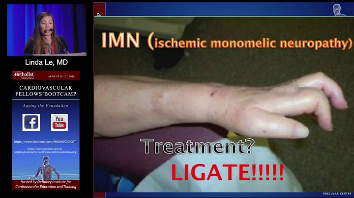 Management of Access STEAL (Linda Le, MD) Sunday, ...