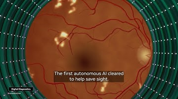 Early Detection with AI Saves Vision