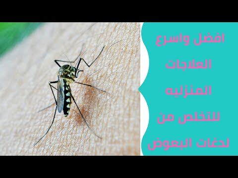 أفضل العلاجات المنزليه للتخلص من لدغات البعوض عالم مهى