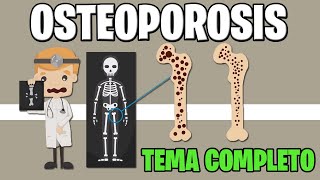 OSTEOPOROSIS  TIPOS CAUSAS DIAGNOSTICO Y PREVENCION