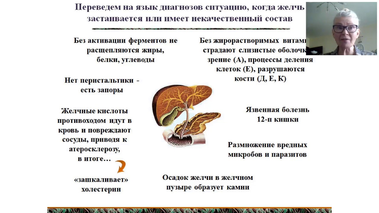 Застой желчного пузыря у взрослого симптомы. Застой желчи и холестерин высокий. Застой желчи влияние на организм.